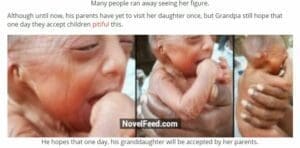 الطفلة المصابة بـ الشيخوخة المبكرة في الهند فتبينوا