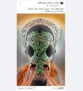 ادعاء دودة تسوس الأسنان