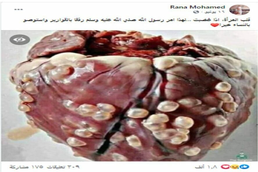 ادعاء قلب المرأة عندما تغضب