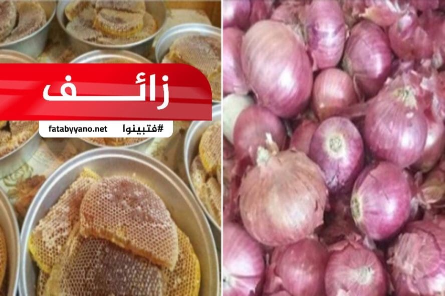 علاج الفشل الكلوي باستخدام عسل النحل وعصير البصل